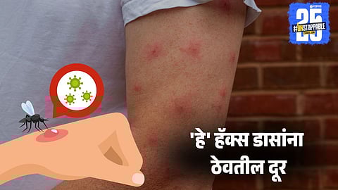 Mosquito Bite Relief: