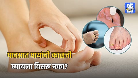 Feet and Infections in Rainy Weather