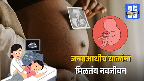 Significant Fetal Mortality Reduction