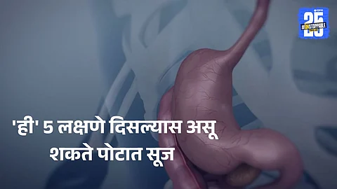 how to identify abdominal bloating symptoms