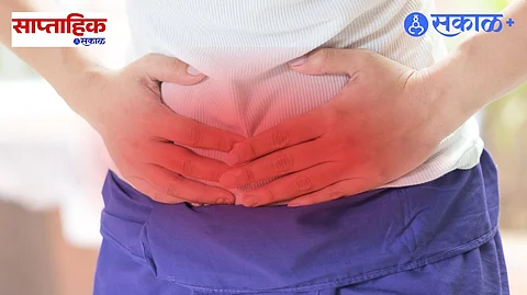 hernia symptoms