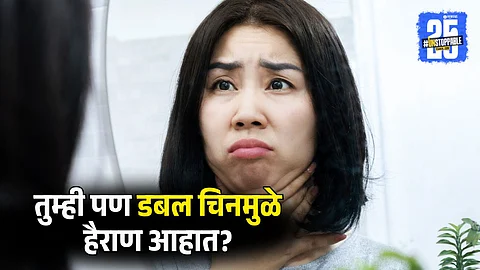Home Remedies for Puffy Face and Bloated Cheeks