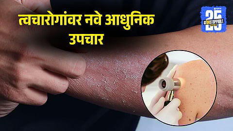 Advanced Skin Disease Treatments at J.J. Hospital