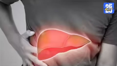 Fatty Liver: तुमचं लिव्हर फॅटी आहे की नाही, घरबसल्या ओळखा; डॉक्टर सरीन यांनी सांगितल्या ट्रिक्स