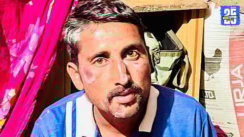 Leopard Strikes Again in Thorandale Area; Young Man Injured in Night Attack