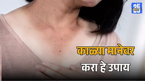 Home Remedies For Dark Neck