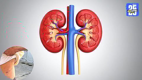 Chandrapur Kidney Racket