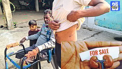 Police officials probing illegal kidney removal case after shocking revelations during investigation.