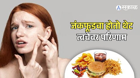 Junk Food Side Effects