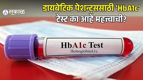 Importance of HbA1c test for diabetes patients