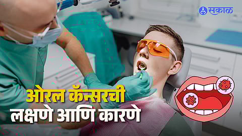 Common Symptoms of Oral Cancer