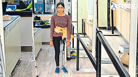 Humanity Triumphs: Vaishnavi Gets Support for Artificial Leg After Tragic Mishap