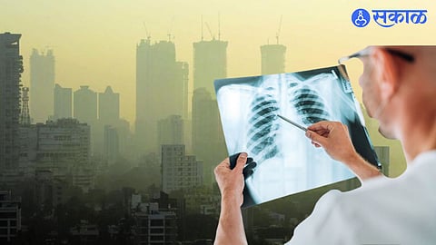 Lung cancer in Mumbai : मुंबईत फुफ्फुसांच्या कर्करोगाच्या ५७ टक्के रुग्णांमध्ये प्रदूषण हेच प्रमुख कारण!