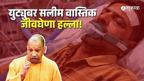 Saleem Wastik youtuber Attack