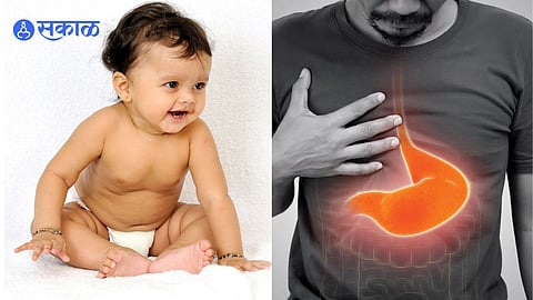 Natural Remedies to Improve Digestion