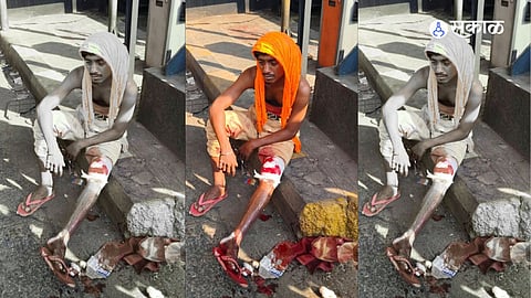 Truck Driver Seriously Injured