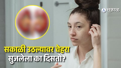 Medical Reasons Behind Face Puffiness