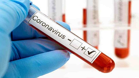 corona virus to live in lab for 28 days the special blog writing in kolhapur