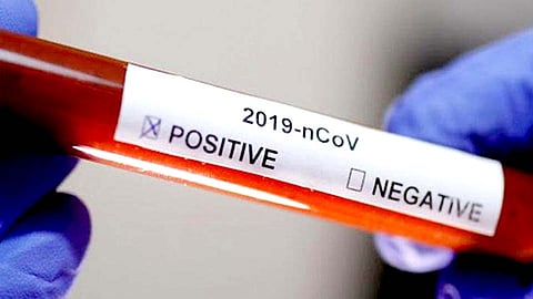 पिंपरी-चिंचवडमधील एकूण पॉझिटिव्ह रुग्ण अन् बरे झालेल्यांची संख्या जाणून घ्या