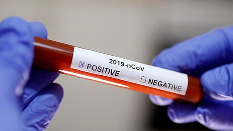 Corona test to be conducted in private lab in Pune.jpg