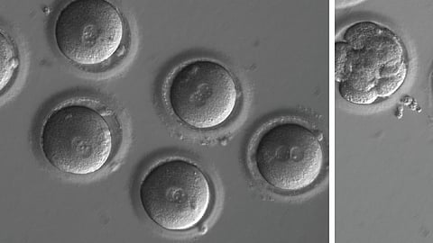 आनुवंशिक आजार इतिहासजमा?