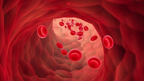 सातपुड्यातील सिकलसेल वर ठोस उपाययोजनांची गरज