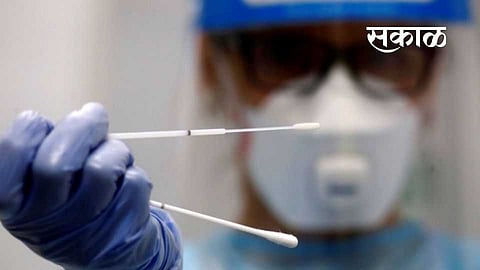 patients are in dangerous situation due to late for corona testing in yavatmal