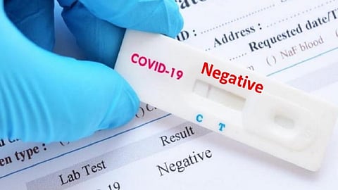 37 journalists corona test report negative