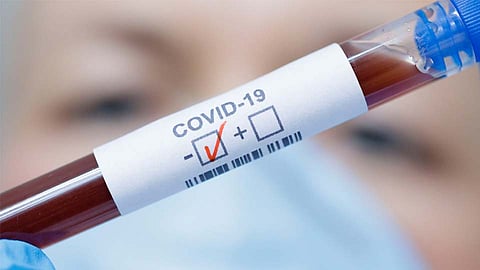 कोरोना रुग्ण संख्येबाबत पिंपरी-चिंचवडकरांना आज दिलासा