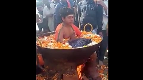 boy sits in boiling water social media viral video explanation