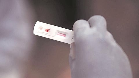 आता समजणार किती जणांना कोरोना होऊन गेलाय, कारण आता होणार 'ही' अत्यंत महत्त्वाची टेस्ट...