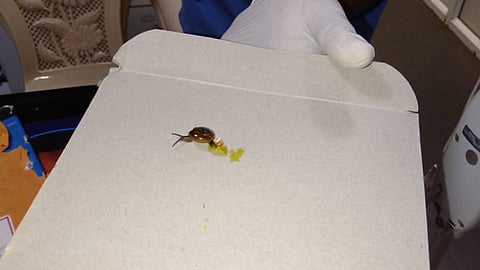 snails in 80 years old man s stomach at satara