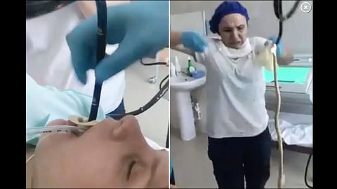doctors pulling snake out of womans throat video viral