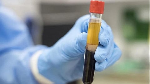 आरोग्योत्सव! लालबाग गणेशोत्सव मंडळांच्या शिबिरात दुप्पट प्लाझ्मा दान; 246 कोरोनामुक्त भक्तांचा शिबिराला प्रतिसाद