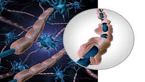 Unmasking Happiness | कोरोनामुक्त रुग्णांना "गुलियन बॅरी सिंड्रोम' आजाराचा धोका