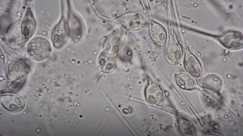 Israeli researchers say theyve found first animal to survive without oxygen