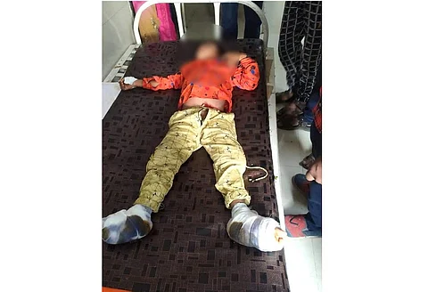 Akola News: Stepmothers mother used to give clicks, son confesses to burning her feet by fire