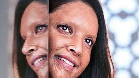 ‘छपाक’चा ट्रेलर लवकरच