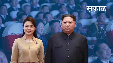 kim jong un