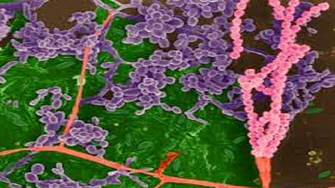 lepto patient found in the sindhudurg district Lepto virus became in sindhudurg