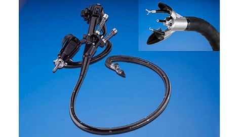 natural orifice transluminal endoscopic surgery