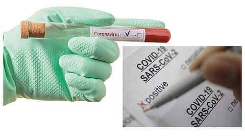 गुड न्यूज : आता ‘कोविड-19’ चाचण्या सातारा जिल्ह्यातच होणार; प्रयोगशाळेस मान्यता