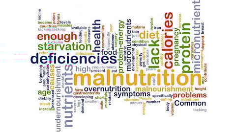 सिंधुदुर्ग जिल्ह्यात अजूनही 389 कुपोषित मुले