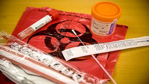 जालना व पुण्यात निकृष्ट कोरोना चाचणी किट्स; पॉझिटीव्ह रेट कमी झाल्याचा दरेकरांचा दावा