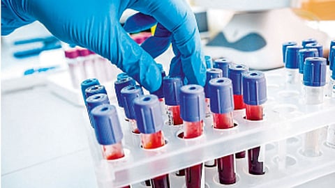 Blood-Test