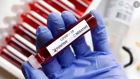 लोणी काळभोरमध्ये आढळले आणखी 31 कोरोनाग्रस्त रुग्ण; रुग्णसंख्या पोहोचली...