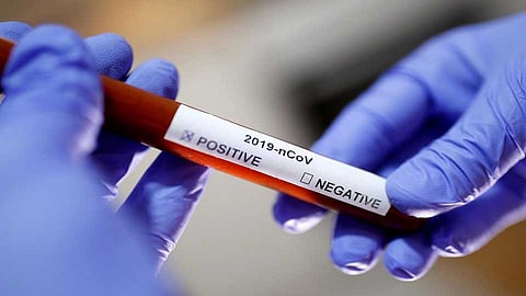 Increase of 165 corona virus patients in 24 hours in Nagar district