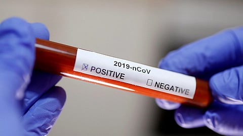 Corona test will be carried out on Serious patients in private hospitals in pune