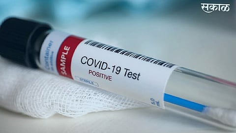 Covid- 19 Effect : संभाव्य धोका टाळण्यासाठी पुढील सात दिवस शाळेला दिली सुटी