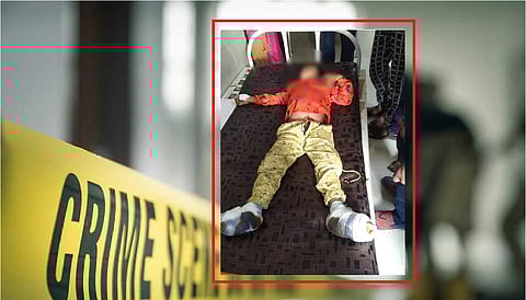 Akola Marathi News Finally, a case was filed against 'that' stepmother, the case of giving clicks to Chimukalya; The boy told Mama